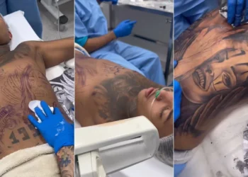 Posso fazer tatuagem anestesiado?