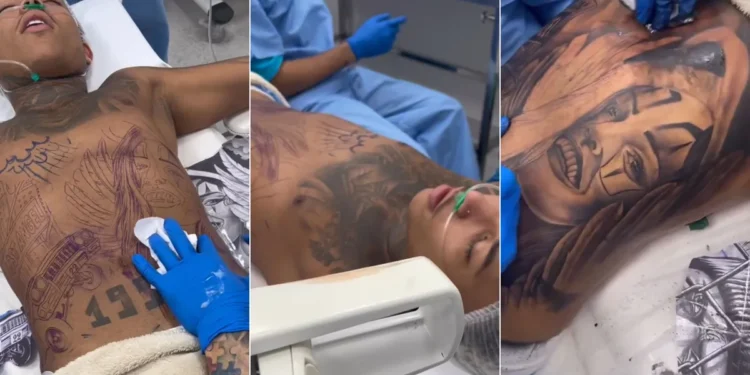 Posso fazer tatuagem anestesiado?