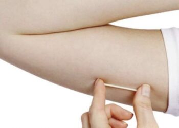 Entenda como funciona o Implanon, novo contraceptivo oferecido pelo SUS