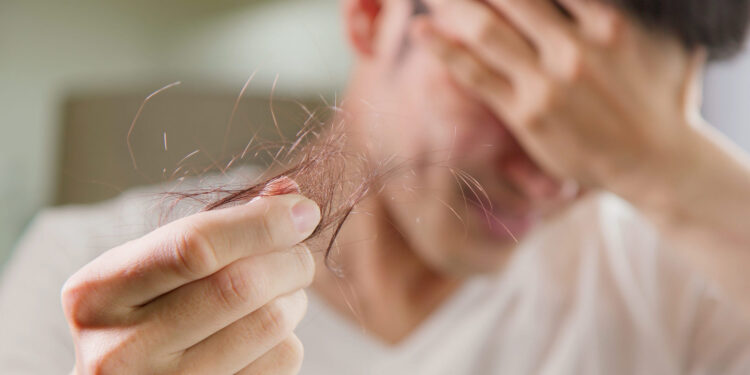 Mito ou verdade: meu cabelo vai cair se eu tomar creatina?