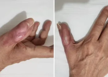 Quais são os cuidados na hora de ir fazer a unha na manicure