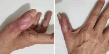 Quais são os cuidados na hora de ir fazer a unha na manicure