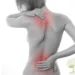 O que é a fibromialgia, doença que será considerada deficiência a partir de 2026