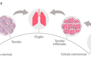 Veja os sinais que podem indicar câncer e que você não deve ignorar
