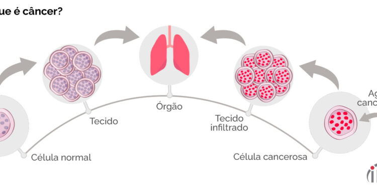 Veja os sinais que podem indicar câncer e que você não deve ignorar